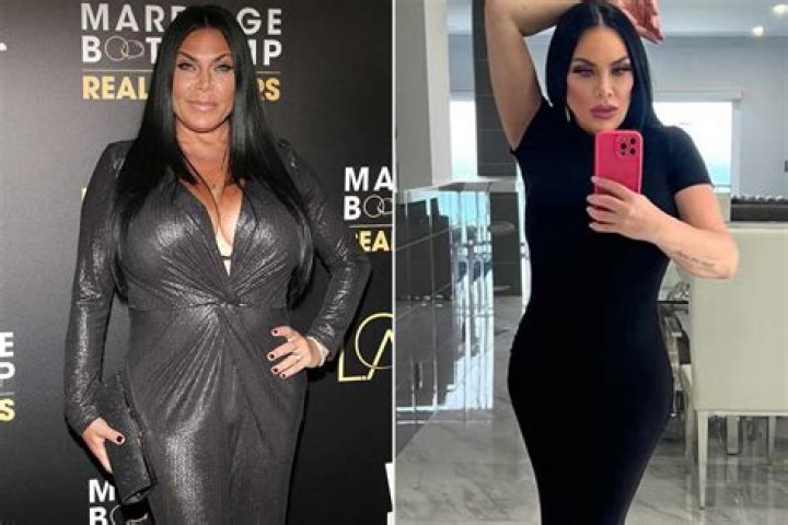 'Mob Wives' Star Renee Graziano: 'I Wake Up Every Day In Pain' After Almost Dying In Surgery