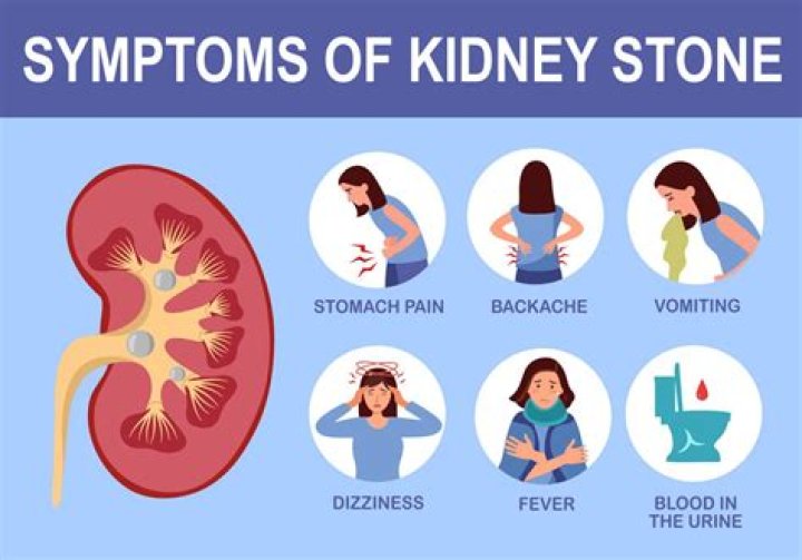 Kidney Stones: 5 Things To Know About Ailment That Sent Liam Hemsworth To The Hospital