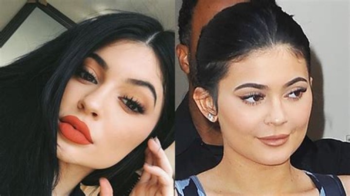 Kylie Jenner’s Lips Almost Downsized Back To Her Original Pout — See First Look